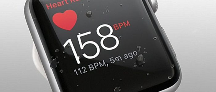Apple-Watch 3 ekg