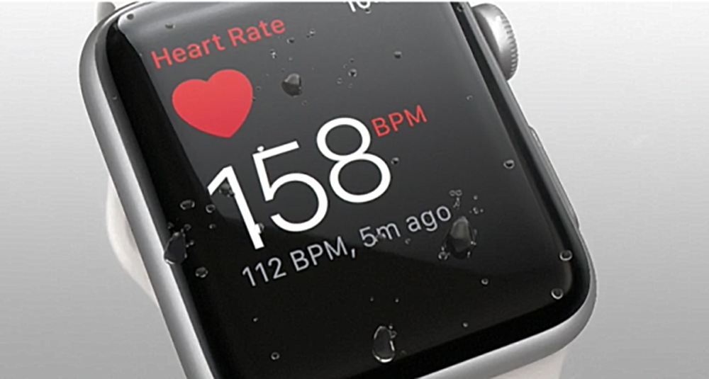 Apple-Watch 3 ekg